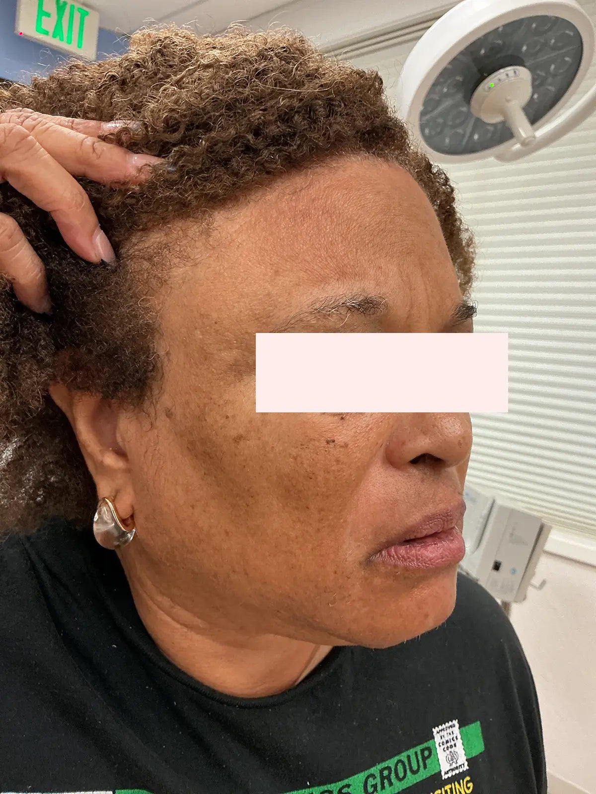 patient after using PantéaMD products 