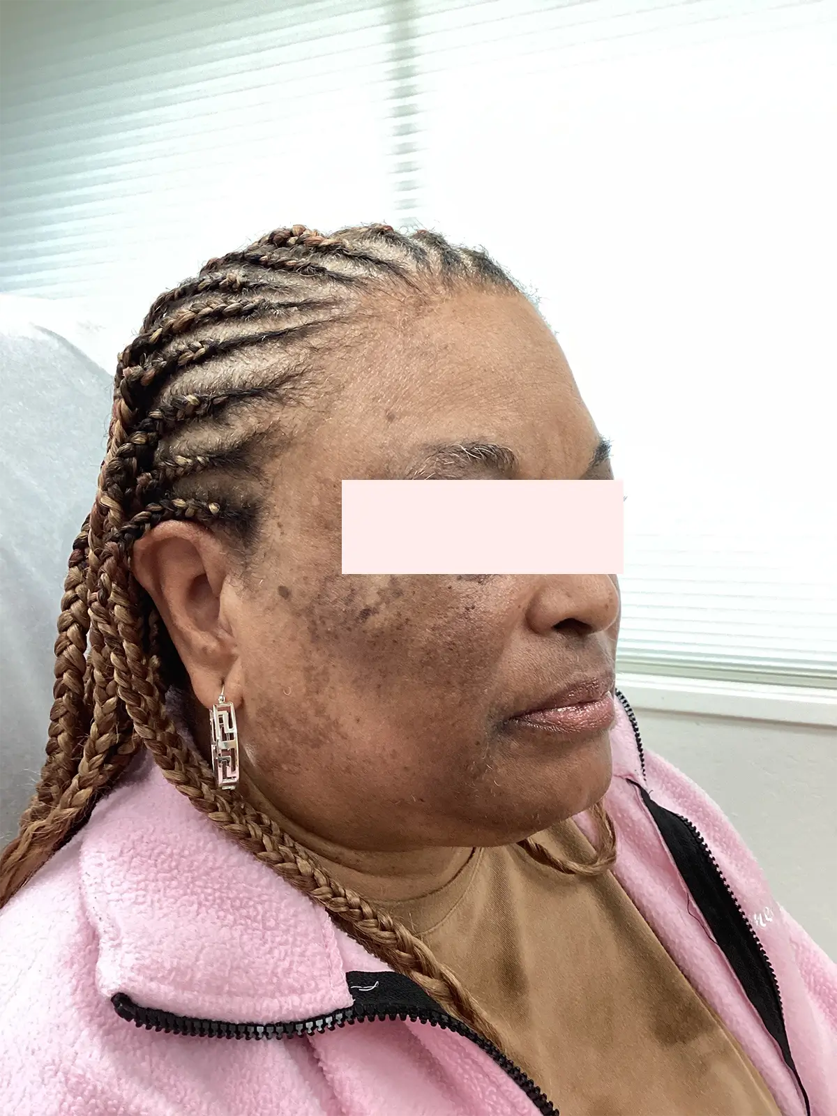 patient before using PantéaMD products 